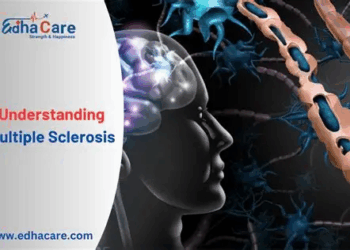 Best Multiple Sclerosis Treatments Approved Worldwide: A Comprehensive Guide